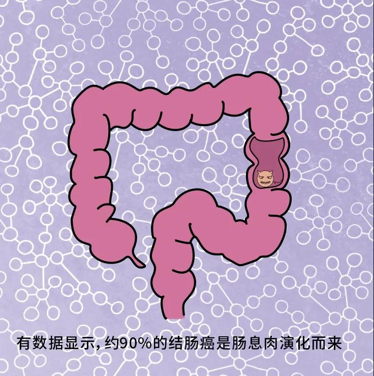 奪走“黑豹”生命的結腸癌，到底什么來頭？