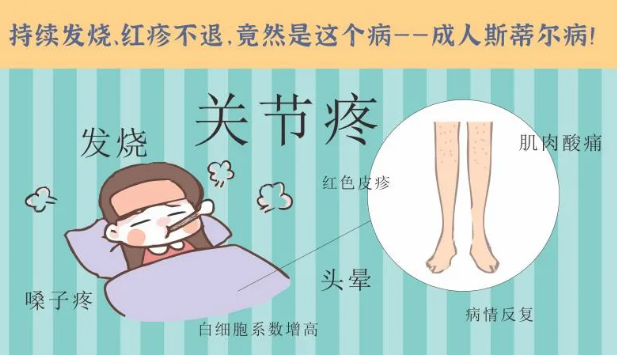 持續(xù)發(fā)燒、紅疹不退……她終于在這里治好了這個罕見病