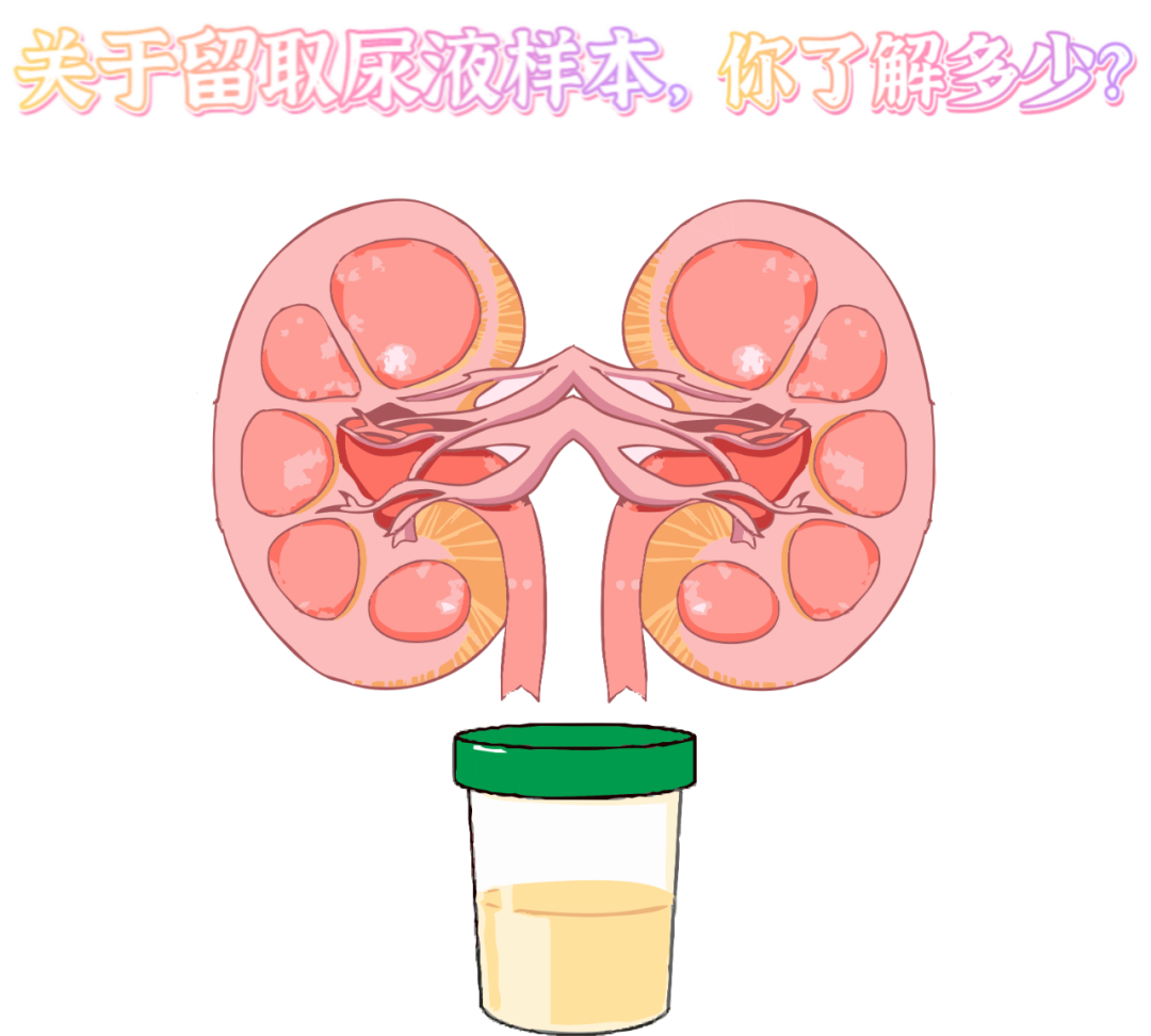 做尿檢，不得不說的注意事項！