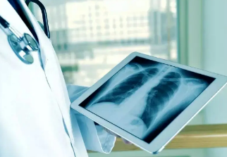 健康呼吸④體檢發(fā)現(xiàn)肺結(jié)節(jié)，我該怎么辦？