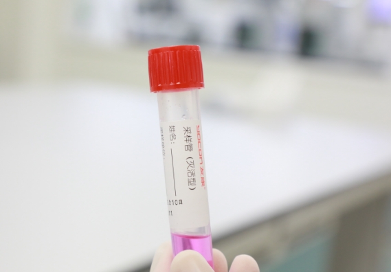 支原體感染檢測手段知多少？