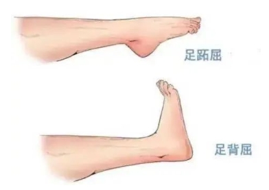 扭胯小連步、動感搖花手……“科目三”雖火，運動損傷也要防！