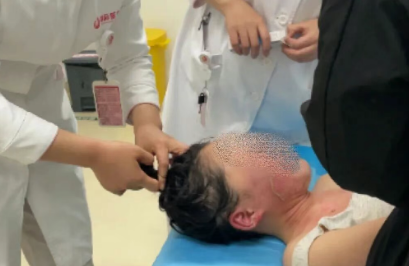 14歲，面、頸、胸燙傷，只因中午那鍋面湯…